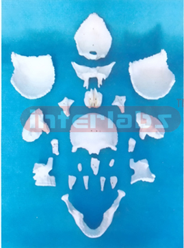 DISARTICULATED SKULL WITH 22 PARTS